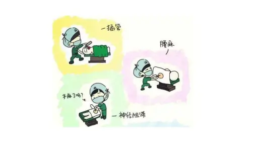 1分钟看懂:全身麻醉是如何实施的?