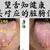人人都学得会的舌诊（第一讲）：望舌知健康-做自己和家人合格的体检医生