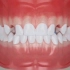 重点关注:乳牙与恒牙接替的换牙期！