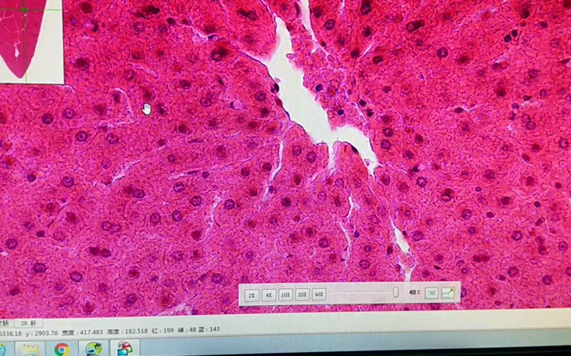 医学生课堂随录2——肝切片