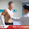 男乳发育——从小学三四年级开始