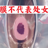 处女膜的种类及其破裂原因