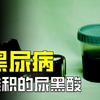 体内组织被“染黑”！排出的尿液像墨水一样黑