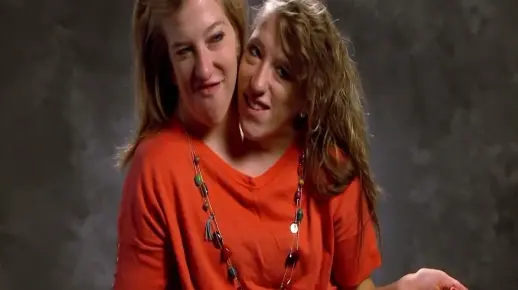 世界十大最诡异的双头动物都有哪些？有的是天生，有的是人为所致