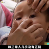 三岁女孩眼睛长虫子，医生看到头皮发麻，从医十年从未见过