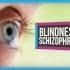 【SciShow Psych】【英字】眼盲和精神分裂症间的诡异联系
