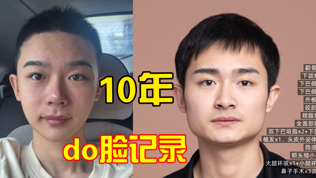 我的青春在整容中度过
