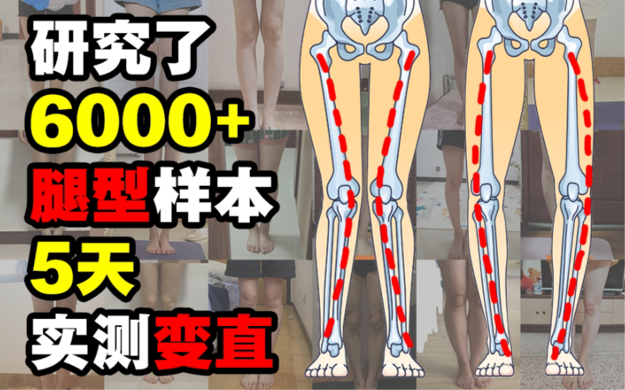 你的腿弯有救了！适用于99%不良腿型的矫正训练