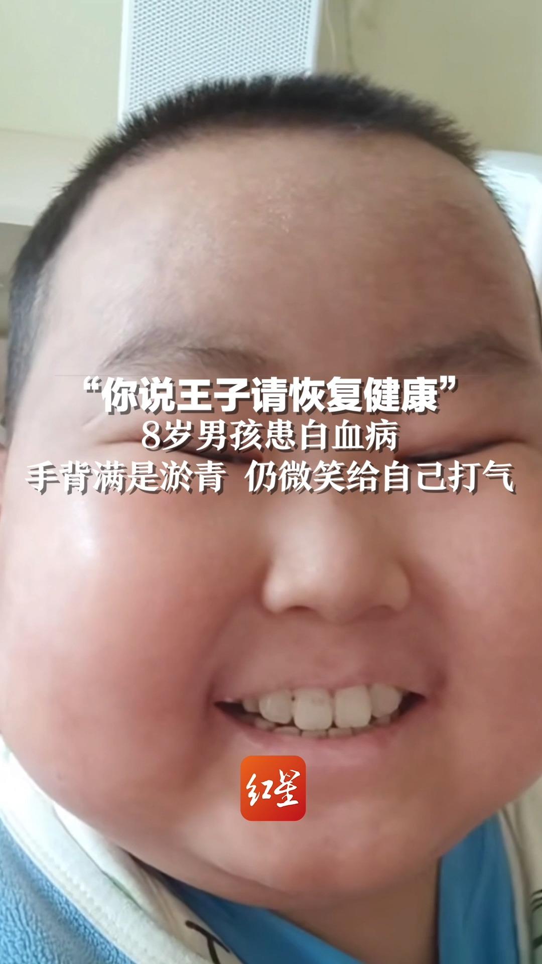 “你说王子请恢复健康”8岁男孩患白血病 ，手背满是淤青，仍微笑给自己打气