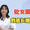 chu女膜到底长啥样