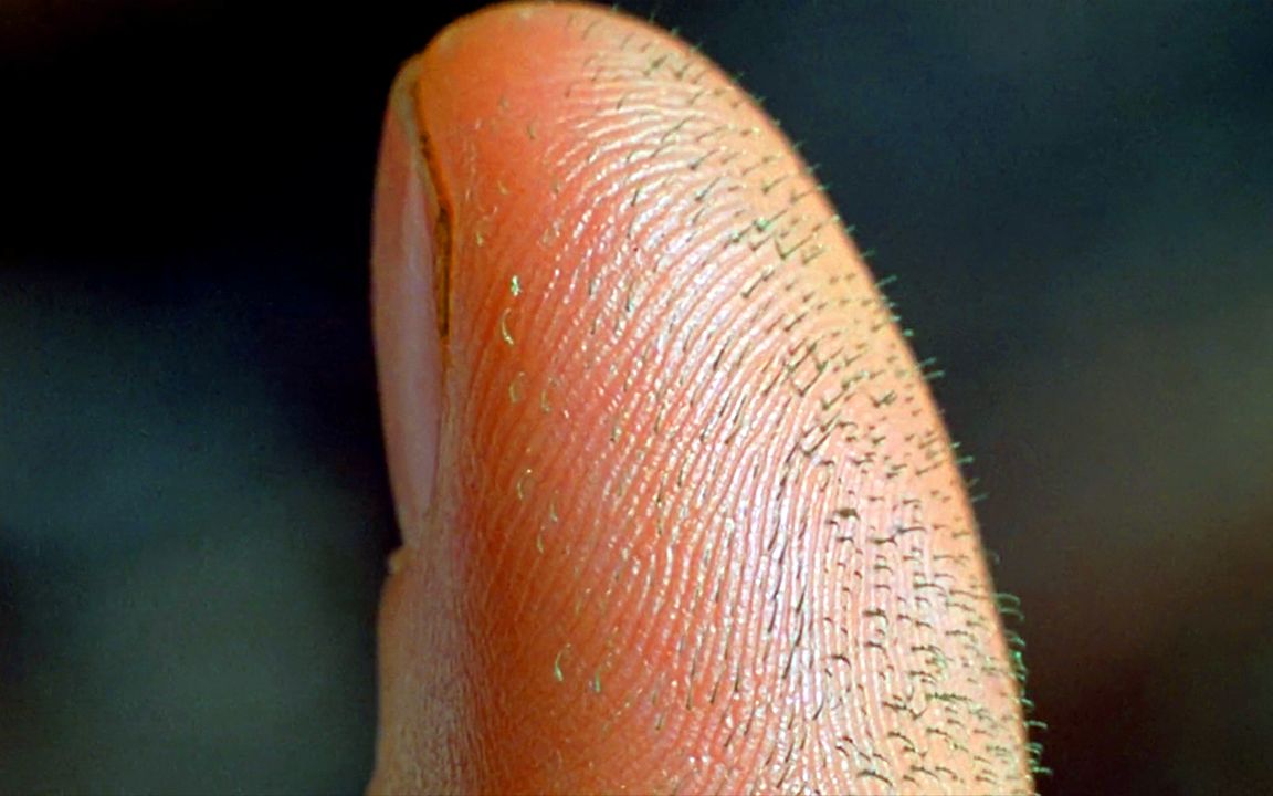 男子被蜘蛛咬了一口，手指长出绿色刺头，原来是蜘蛛的“爪子”!