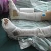 妻子不堪丈夫暴打为逃生跳楼摔成瘫痪   监控拍下揪心全程