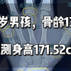 12岁男孩，骨龄13.2岁，预测身高171.52cm