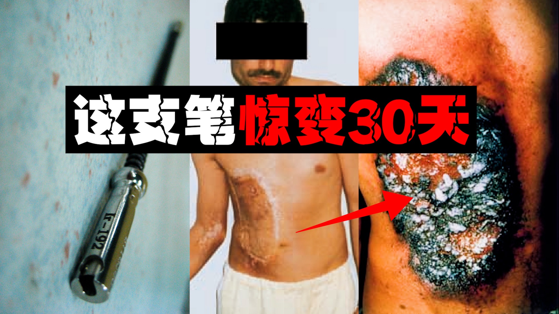 【腐烂之核】小伙带辐射源上班600人遭殃，集体变异溃烂。。。