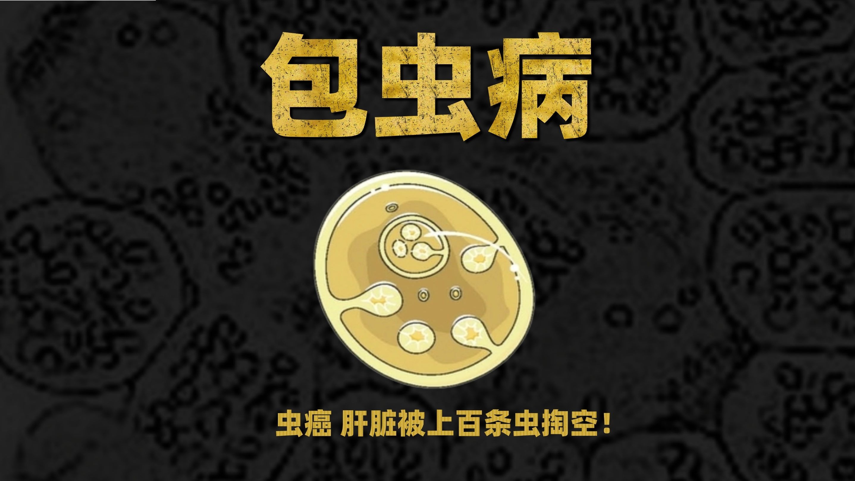 有着虫癌之称的寄生虫病，肝脏被数百条寄生虫肯穿！