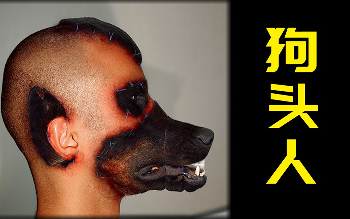 巴西一男子渴望变成狗，于是把狗头缝在脸上，将自己整容成狗！传说中的半兽人真的存在吗？