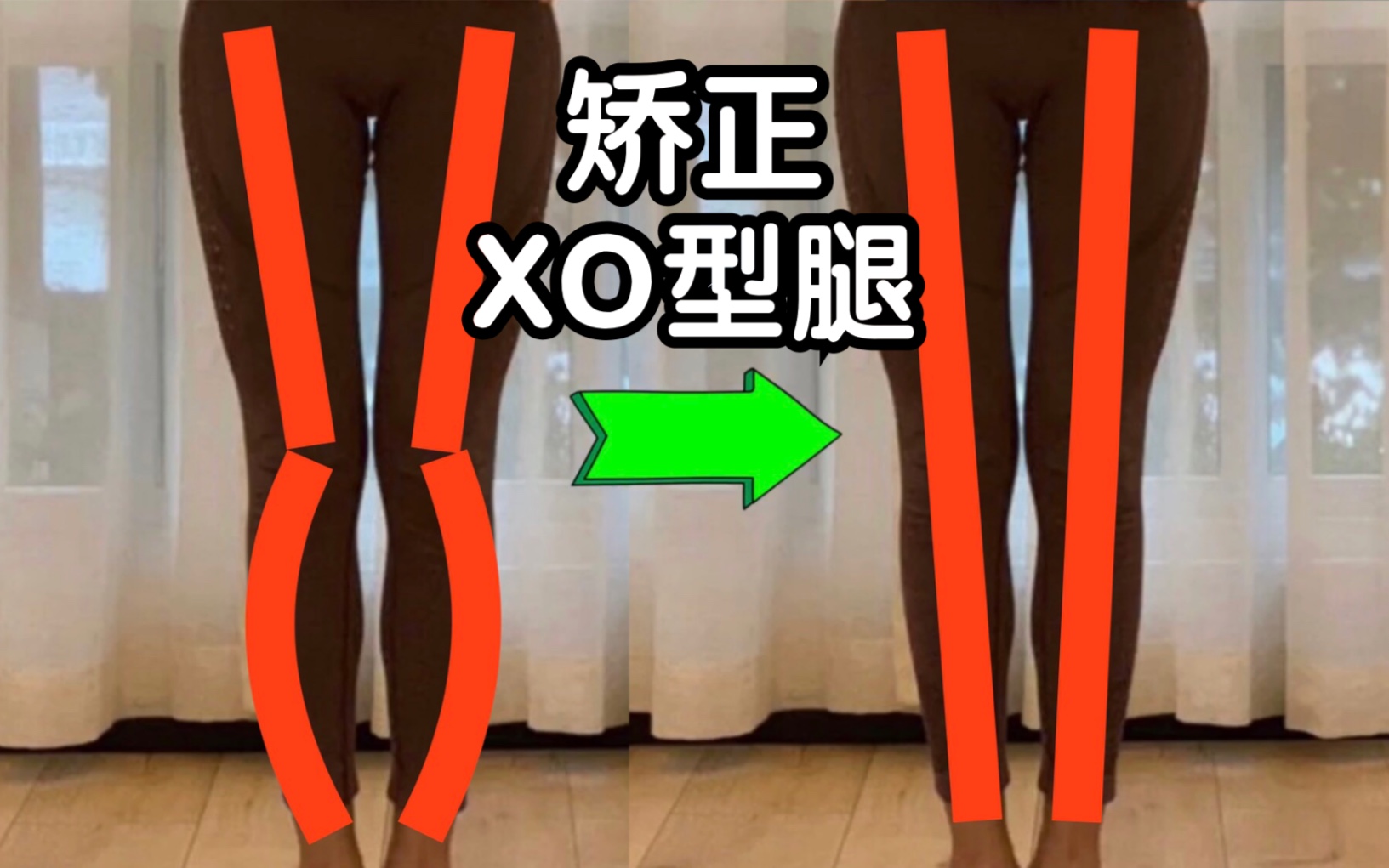 【直腿】教你4招矫正XO型腿！这变化也 太快了！