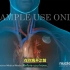 【3D医学动画】心脏起搏器置入（中英双字幕）