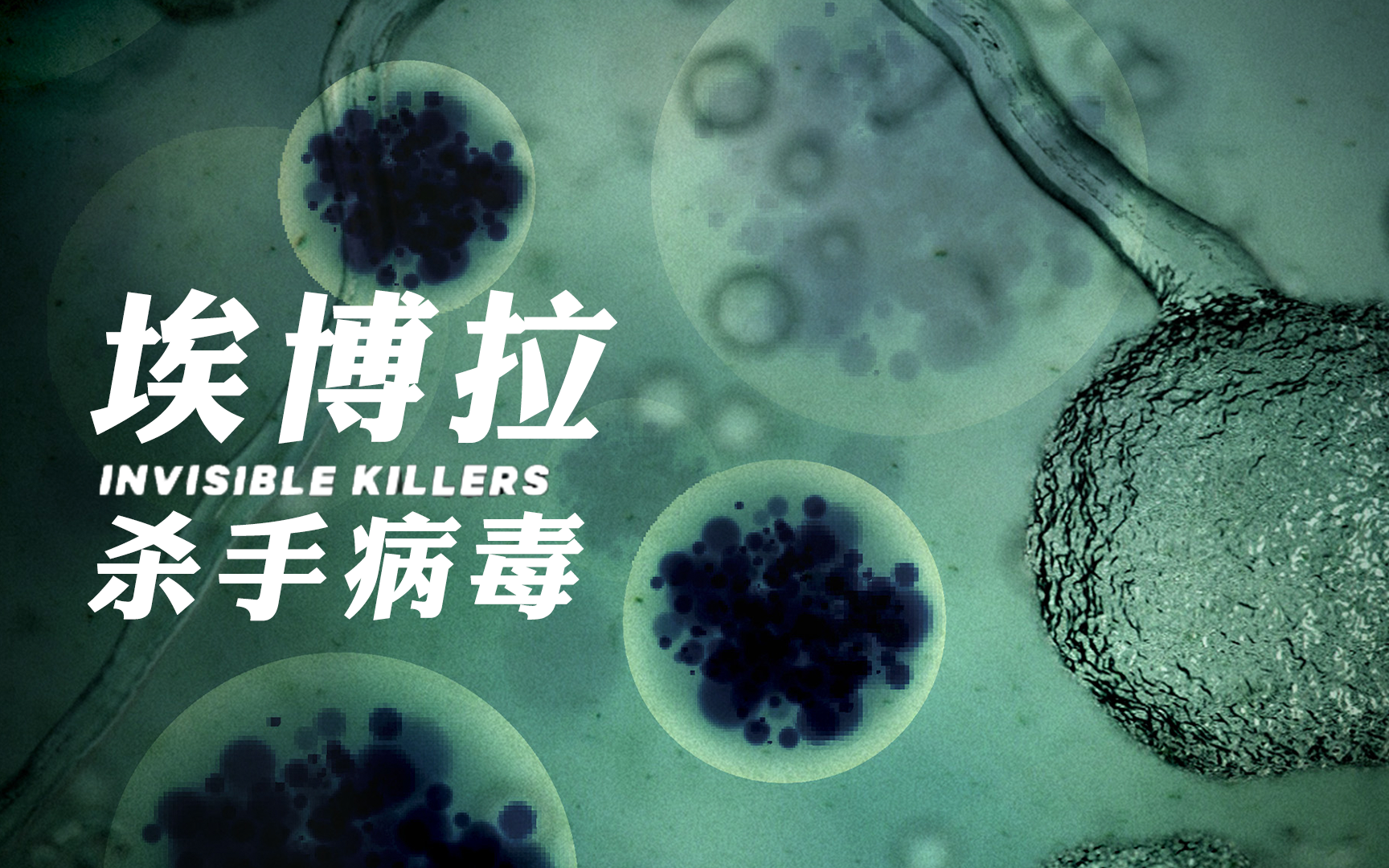 【纪录片】杀手病毒 03 埃博拉