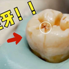 第1视角清理蛀牙，用电钻将牙齿掏空，牙齿棱角被钻平，看着真疼