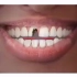 门牙可是门面担当，缺损、龋坏、变色、牙缝大能行！？如何解决？一起来看看！「大连齿医生口腔修复中心」「大连口腔医院」