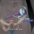 腹腔镜手术过程，3D演示。。