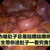 为啥肚子总是咕噜咕噜响？原来是肠管在动，医生带你进肚子里一看究竟