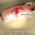 肩袖损伤手术修复过程，3D演示。。