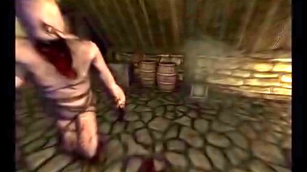 【逃亡开始】失忆症第二期，这是下巴还是嘴？