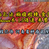 双两孔法胸腹腔镜 食管癌Mckeown术 1.5倍速未剪辑 程纪伟教授供稿