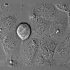 显微镜下的癌细胞分裂