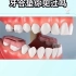 牙合垫如何调整咬姿？帮你笑出强大，一起来看看「大连齿医生口腔修复中心」「大连口腔医院」