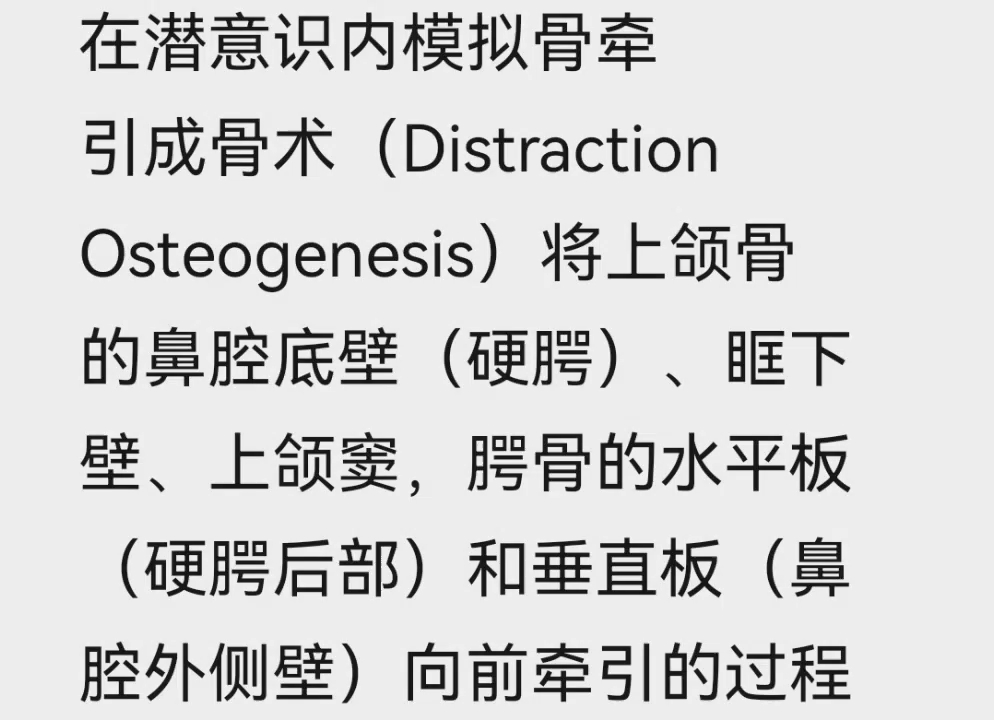 【Trumona】DO模拟