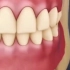 你的牙齿黄吗？动画带你了解一下牙齿美白