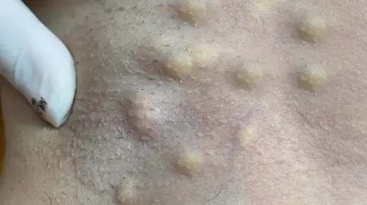 腋下