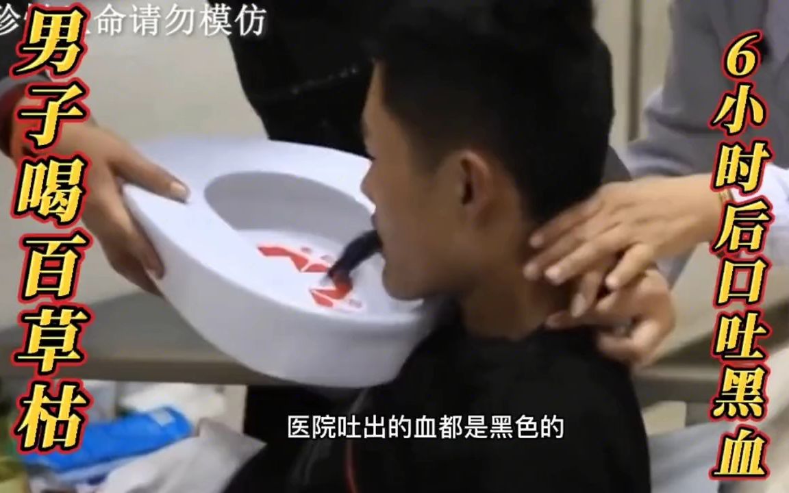 男子喝百草枯,口吐黑血,27天后抢救无效死亡_哔哩哔哩_bilibili