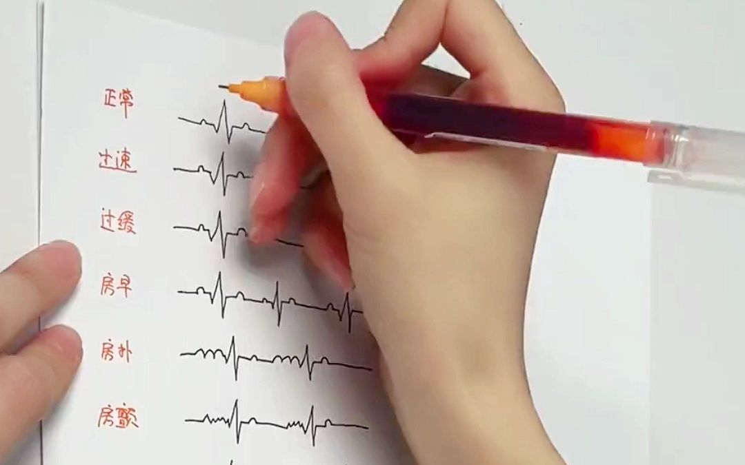 心电图异常怎么看？