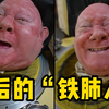 世界上最后一个“铁肺人”的乐观人生