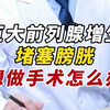 巨大前列腺增生 堵塞膀胱 不想做手术怎么办