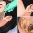 【沉浸式美妆】耳垢清洁及面部护理动画
