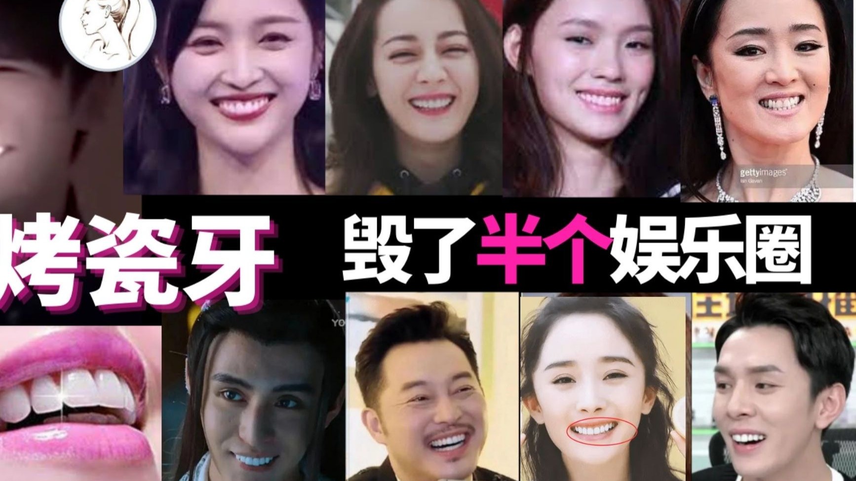 烤瓷牙：害了半个娱乐圈！