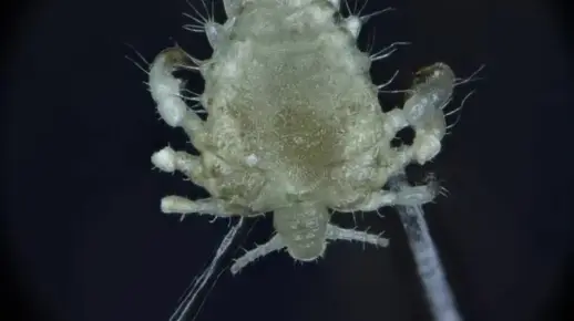 阴虱一天产多少卵？#虱子 #虱子卵 #虱子是怎么来的