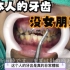 27岁日本男人满口烂牙，牙齿不好看，一个女朋友都没有！
