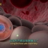 【中英文双语字幕版】【3D医学动画】艾滋病病毒 艾滋病动画 - HIV AIDS Animation | Elara S