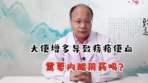 大便增多导致痔疮便血，需要内服用药吗？刘伟医生：要记住这1点