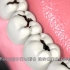 00:02/01:05蛀牙真是被“虫子”吃空的吗？3D动画演示牙坏掉的过程