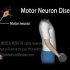 【动画展示】运动神经元疾病⚡