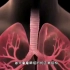 肺癌的发生过程，3D演示。。