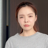 有没有人告诉我泪失禁体质到底怎么破啊