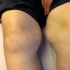 張孟超醫師－望診- 膝內側肌肉肥厚-膝關節無力 (1)